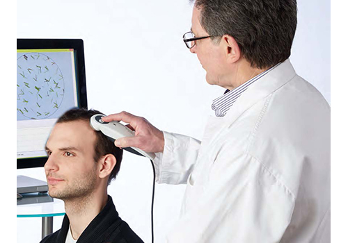 TrichoScan HD毛发分析系统